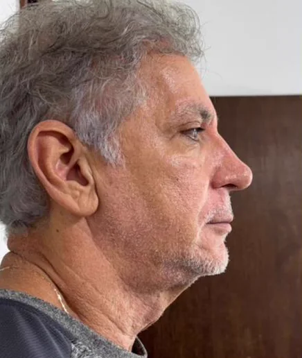 Depois do Microfocado: cliente de perfil.