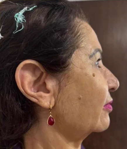 Depois do Microfocado: cliente de perfil.
