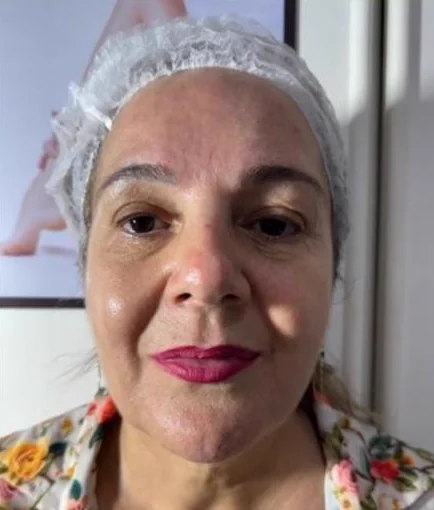 Antes do Microfocado: cliente de frente.