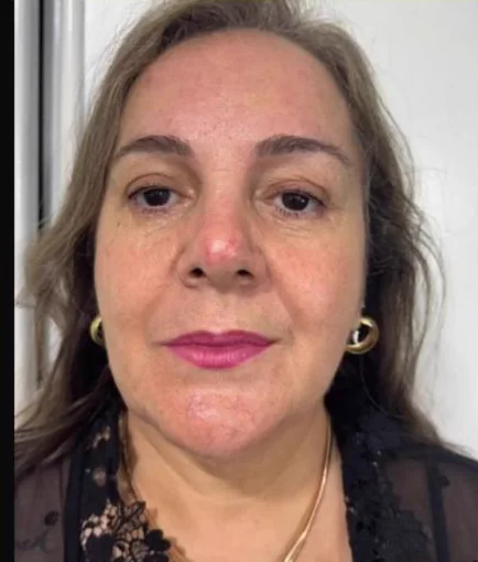 Depois do Microfocado: cliente de frente.